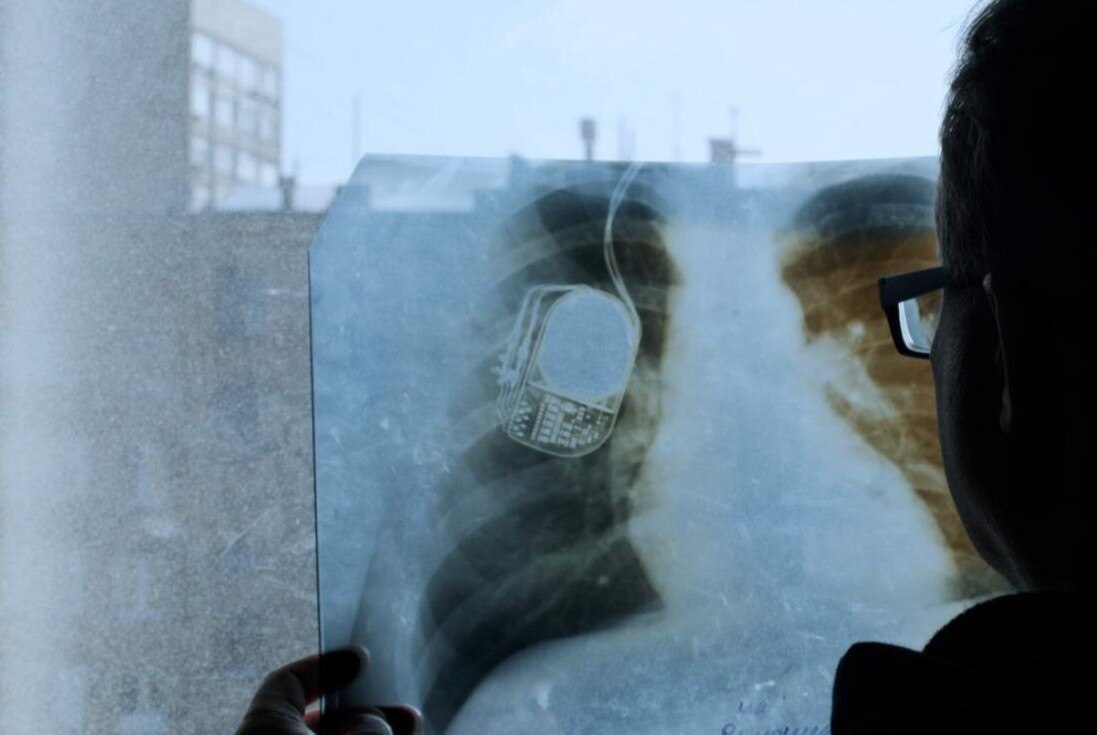 Дни научного кино! "Чип внутри меня" 12+