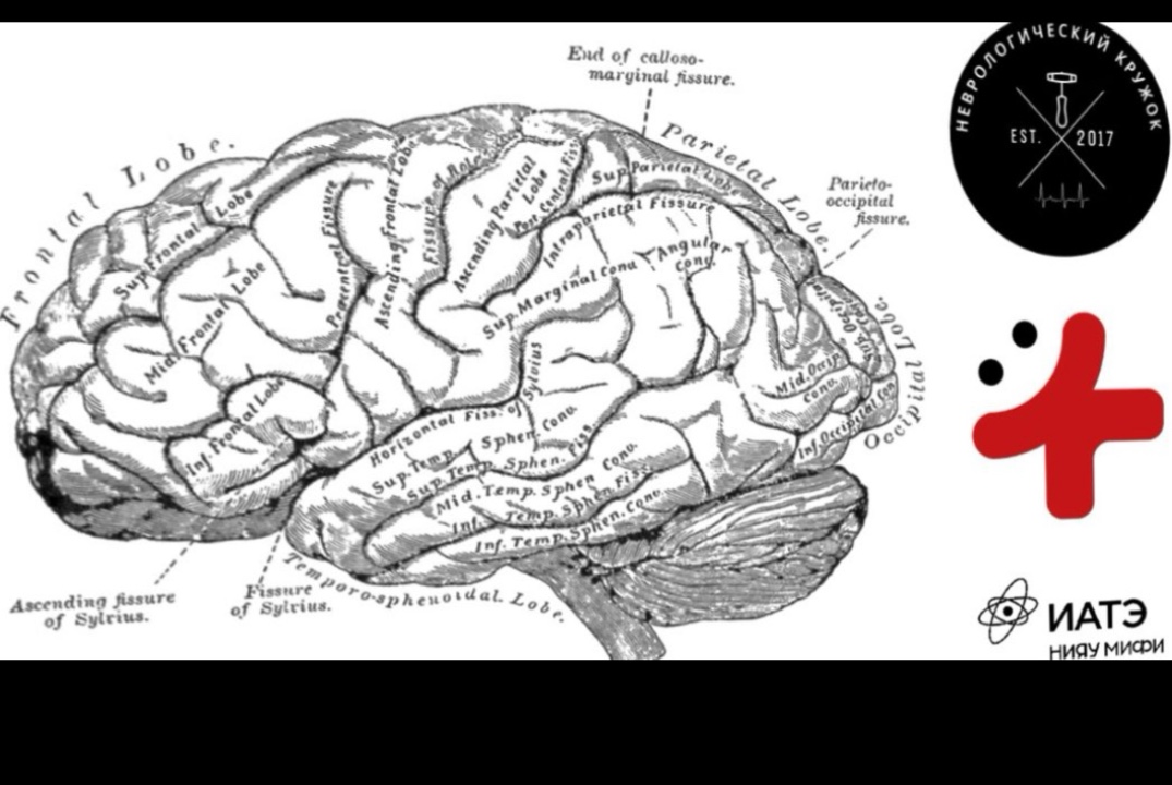 Школа инсульта