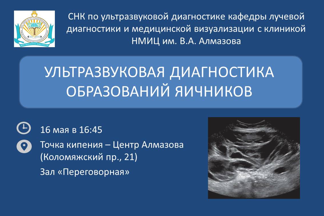 Ультразвуковая диагностика образований яичников