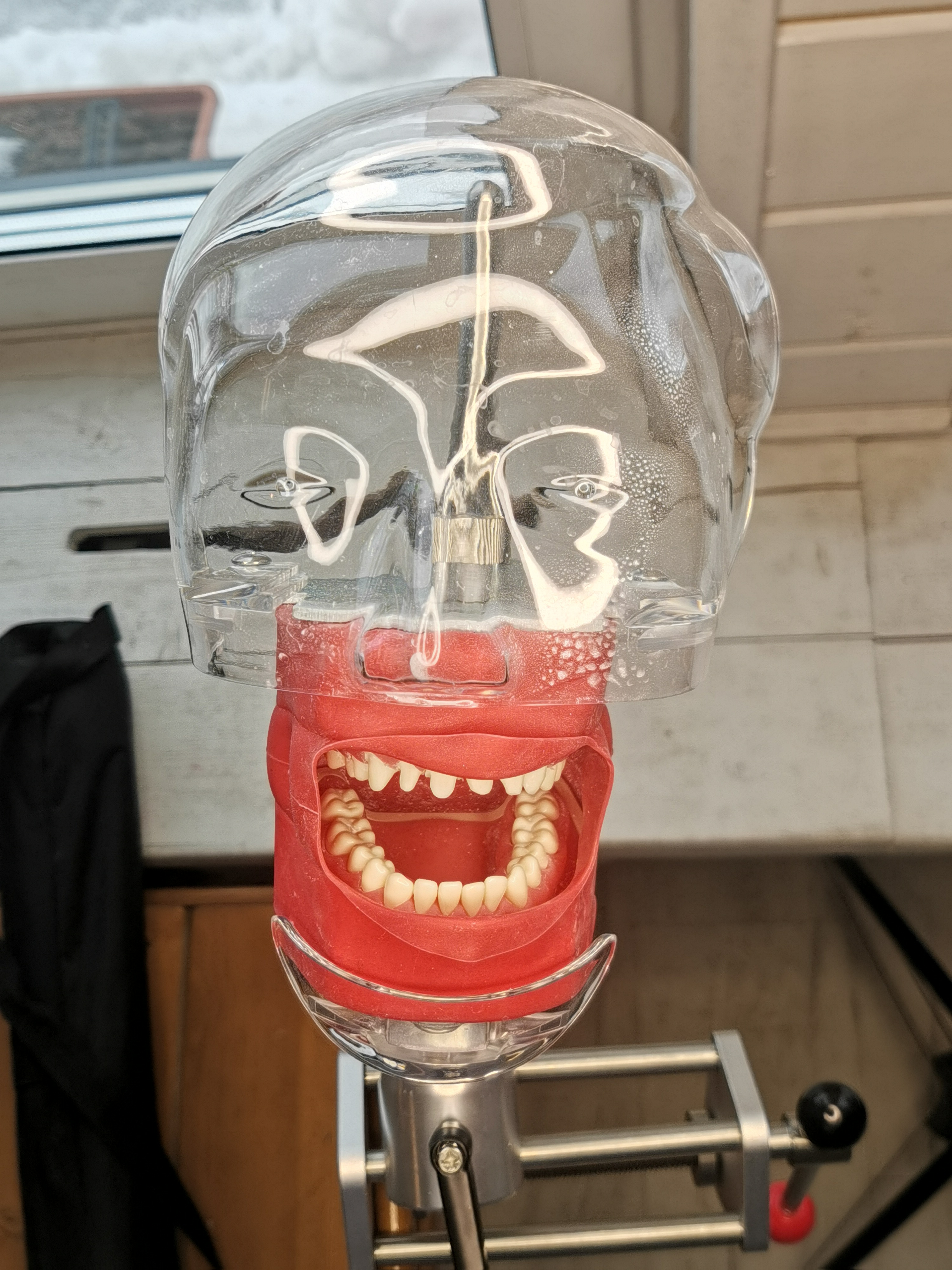 Механика несьемного протезирования. Основы и принципы.