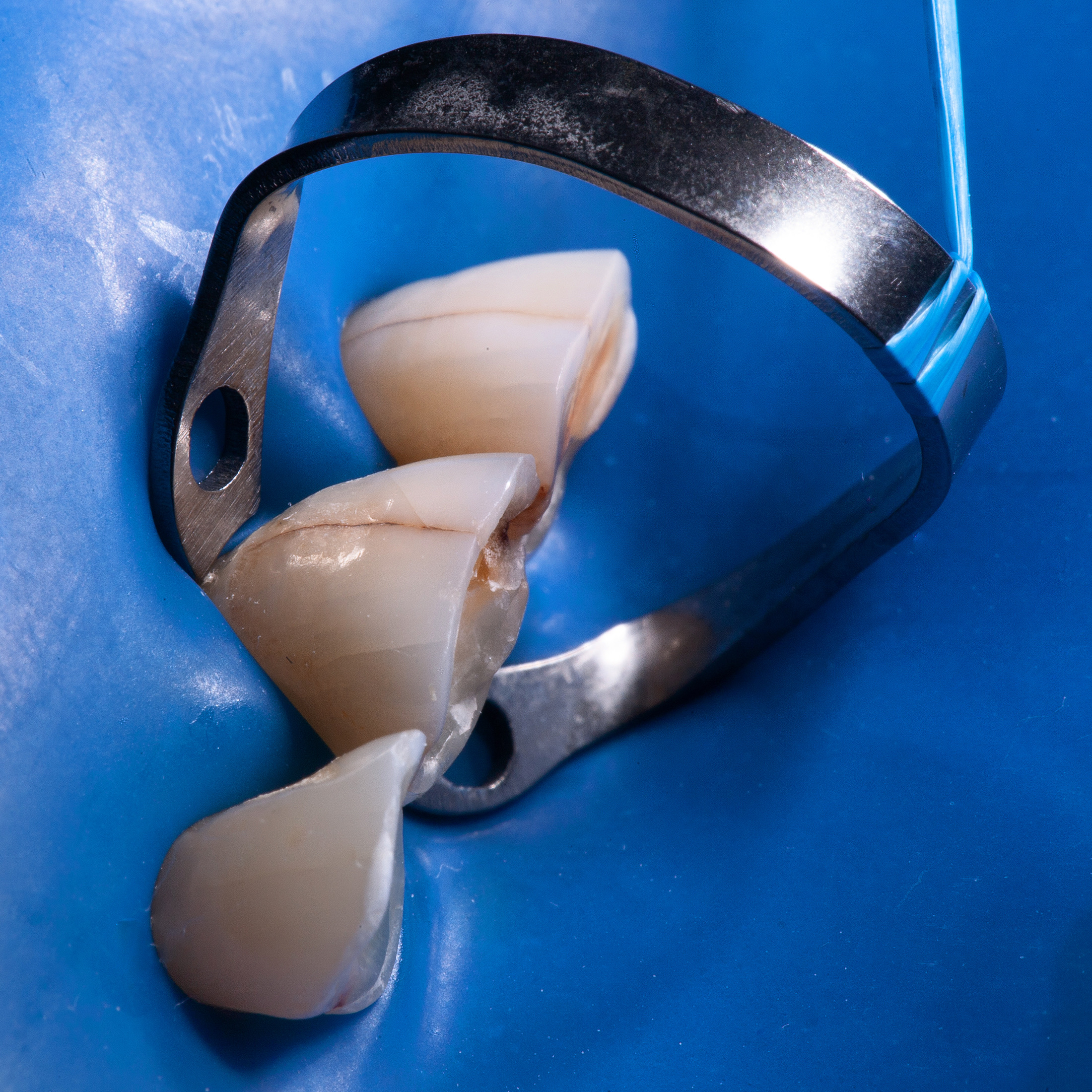 Дентальная фотография