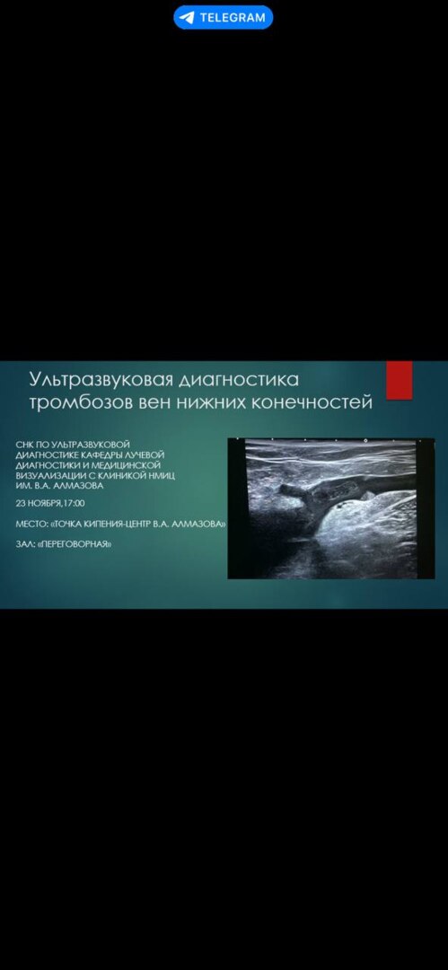 Ультразвуковая диагностика тромбозов вен нижних конечност...